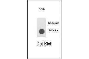 Dot blot analysis of anti-Phospho ILK- Pab (ABIN650820 and ABIN2839796) on nitrocellulose membrane. (ILK Antikörper  (pSer343))