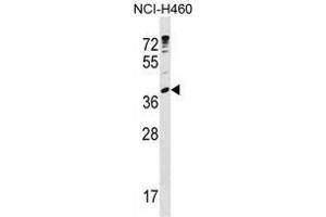 UBE2U Antibody (N-term) western blot analysis in NCI-H460 cell line lysates (35 µg/lane). (UBE2U Antikörper  (N-Term))