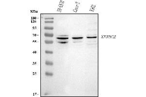 anti-5'-Nucleotidase Domain Containing 2 (NT5DC2) (AA 9-520) antibody