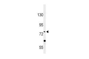 Western blot analysis of PLA2G6 Antibody in HepG2 cell line lysates (35ug/lane) (PLA2G6 Antikörper  (AA 551-580))