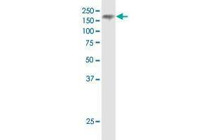 Western Blotting (WB) image for anti-Niemann-Pick Disease, Type C1 (NPC1) (AA 151-250) antibody (ABIN562034)