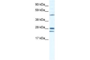 Western Blotting (WB) image for anti-Gap Junction Protein, beta 2, 26kDa (GJB2) antibody (ABIN2461384) (GJB2 Antikörper)