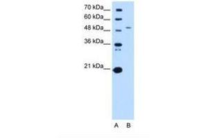 Image no. 2 for anti-serine Palmitoyltransferase, Long Chain Base Subunit 1 (SPTLC1) (AA 254-303) antibody (ABIN6738265) (SPTLC1 Antikörper  (AA 254-303))