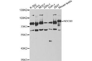 Western blot analysis of extracts of various cell lines, using NDC80 antibody (ABIN6292982) at 1:1000 dilution. (NDC80 Antikörper)