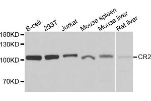 Western blot analysis of extracts of various cell lines, using CR2 antibody. (CD21 Antikörper)