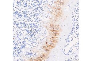 IHC analysis of COMP using anti-COMP antibody (ABIN6719297).