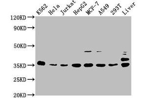 PSMD14 Antikörper  (Regulatory Subunit 14)