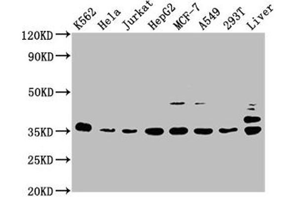 PSMD14 Antikörper  (Regulatory Subunit 14)