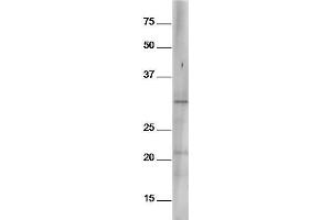 Mouse spleen lysates probed with Anti-Bcl-2 (Ser70) Polyclonal Antibody, Unconjugated  at 1:5000 90min in 37˚C (Bcl-2 Antikörper  (pSer70))