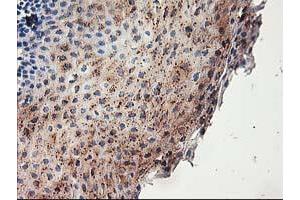 Immunohistochemical staining of paraffin-embedded Human tonsil using anti-ACSS2 mouse monoclonal antibody. (ACSS2 Antikörper)