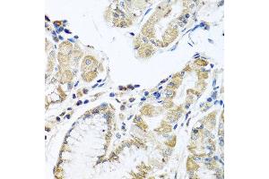 Immunohistochemistry of paraffin-embedded human stomach using IFNL3 antibody at dilution of 1:100 (40x lens). (IL28B Antikörper)