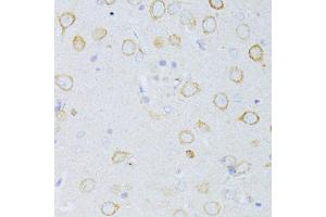 Immunohistochemistry of paraffin-embedded rat brain using CD63 antibody (ABIN5974980) at dilution of 1/100 (40x lens). (CD63 Antikörper)