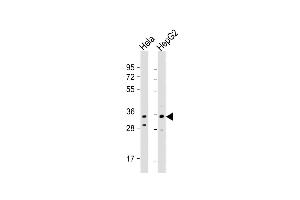 All lanes : Anti-I Antibody (C-term) at 1:1000 dilution Lane 1: Hela whole cell lysate Lane 2: HepG2 whole cell lysate Lysates/proteins at 20 μg per lane. (IMP4 Antikörper  (C-Term))