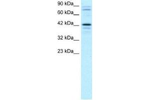 Human Jurkat; WB Suggested Anti-SOX18 Antibody Titration: 2. (SOX18 Antikörper  (Middle Region))