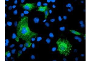 Anti-KATNB1 mouse monoclonal antibody (ABIN2455206) immunofluorescent staining of COS7 cells transiently transfected by pCMV6-ENTRY KATNB1 (RC201852). (KATNB1 Antikörper)