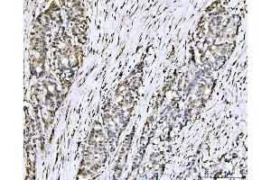 IHC analysis of PC4/SUB1 using anti-PC4/SUB1 antibody (ABIN7602184). (SUB1 Antikörper  (AA 62-127))