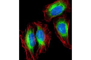 Immunofluorescence (IF) image for anti-Nestin (NES) (AA 1389-1416) antibody (ABIN388764)