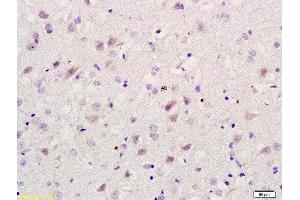 Formalin-fixed and paraffin embedded rat brain labeled with Rabbit Anti RBBP5 Polyclonal Antibody, Unconjugated  at 1:200 followed by conjugation to the secondary antibody and DAB staining (RBBP5 Antikörper  (AA 131-230))