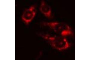 ABIN6274207 staining Hela cells by IF/ICC. (DTYMK Antikörper  (Internal Region))