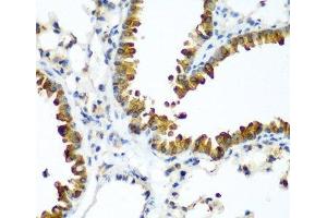 Immunohistochemistry of paraffin-embedded Mouse lung using TAZ Polyclonal Antibody at dilution of 1:200 (40x lens). (TAZ Antikörper)