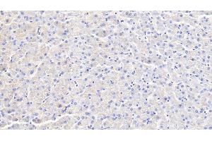 Immunohistochemistry (IHC) image for anti-Interferon gamma (IFNG) (AA 24-166) antibody (ABIN7429796)