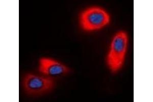 Immunofluorescent analysis of CHST9 staining in HepG2 cells. (CHST9 Antikörper  (C-Term))