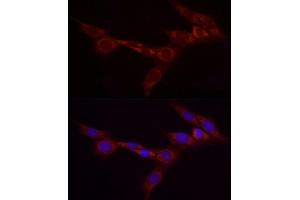 Immunofluorescence analysis of NIH/3T3 cells using Bcdin3d Rabbit pAb (ABIN7265842) at dilution of 1:25 (40x lens). (BCDIN3D Antikörper)