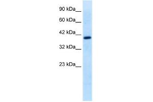 WB Suggested Anti-TFEB Antibody Titration:  0. (TFEB Antikörper  (Middle Region))