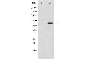 Western blot analysis of Chk2 phosphorylation expression in UV treated COS7 whole cell lysates,The lane on the left is treated with the antigen-specific peptide. (CHEK2 Antikörper  (pThr383))