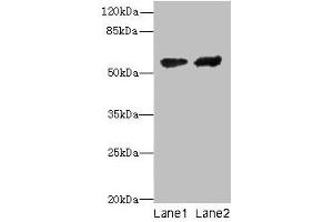 Western blot All lanes: CYP17A1 antibody at 12 μg/mL Lane 1: Hela whole cell lysate Lane 2: A549 whole cell lysate Secondary Goat polyclonal to rabbit IgG at 1/10000 dilution Predicted band size: 58 kDa Observed band size: 58 kDa (CYP17A1 Antikörper  (AA 24-508))
