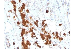 Formalin-fixed, paraffin-embedded human Pituitary stained with ACTH Monoclonal Antibody (SPM333). (POMC Antikörper  (AA 1-24))