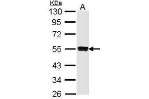 WB Image Sample (30 ug of whole cell lysate) A: Molt-4 , 10% SDS PAGE antibody diluted at 1:1000 (TRIM21 Antikörper)