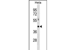 CBX8 Antibody  (ABIN389089 and ABIN2839284) western blot analysis in Hela cell line lysates (35 μg/lane). (CBX8 Antikörper  (C-Term))