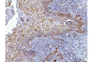 IHC analysis of HGS using anti-HGS antibody (ABIN7601207).