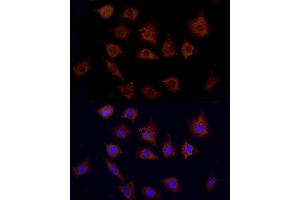 Immunofluorescence analysis of L929 using CPT1C antibody (ABIN6130131, ABIN6138980, ABIN6138981 and ABIN6217987) at dilution of 1:100. (CPT1C Antikörper  (AA 270-400))