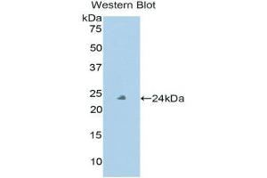 Western Blotting (WB) image for anti-Peroxidasin Homolog (PXDN) (AA 76-260) antibody (ABIN1860379) (Peroxidasin Antikörper  (AA 76-260))