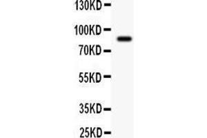 Western Blotting (WB) image for anti-Gelsolin (GSN) (AA 580-782) antibody (ABIN3042436)