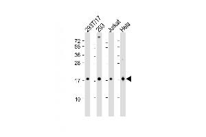 All lanes : Anti-SUMO4 Antibody (M55 Wild type) at 1:2000 dilution Lane 1: 293T-17 whole cell lysate Lane 2: 293 whole cell lysate Lane 3: Jurkat whole cell lysate Lane 4: Hela whole cell lysate Lysates/proteins at 20 μg per lane.