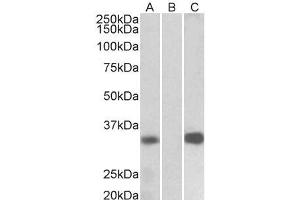 HEK293 lysate (10ug protein in RIPA buffer) overexpressing Human KCNIP3 with C-terminal MYC tag probed with ABIN5539711 (1ug/ml) in Lane A and probed with anti-MYC Tag (1/1000) in lane C.