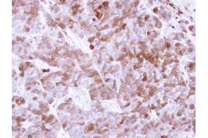 IHC-P Image Immunohistochemical analysis of paraffin-embedded H520 xenograft, using Factor XIIIa, antibody at 1:500 dilution. (F13A1 Antikörper  (N-Term))