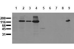 Western Blotting (WB) image for anti-Cadherin 2 (CDH2) antibody (ABIN126737) (N-Cadherin Antikörper)