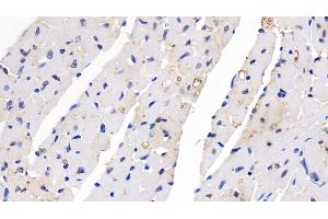 Detection of SEMA5B in Mouse Cardiac Muscle Tissue using Polyclonal Antibody to Semaphorin 5B (SEMA5B) (SEMA5B Antikörper  (AA 836-1013))