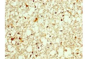 IHC image of ABIN7155839 diluted at 1:250 and staining in paraffin-embedded human brain tissue performed on a Leica BondTM system. (OTX2 Antikörper  (AA 1-297))