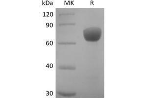 Western Blotting (WB) image for SLAM Family Member 7 (SLAMF7) protein (mFc Tag) (ABIN7319883)