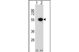Western blot analysis of RUVBL1 (arrow) using rabbit polyclonal RUVBL1 Antibody (ABIN650671 and ABIN2838241). (RUVBL1 Antikörper)