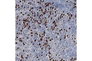 Immunohistochemical staining of human spleen with OTOA polyclonal antibody  shows strong cytoplasmic positivity in cells of red pulp at 1:50-1:200 dilution. (OTOA Antikörper)