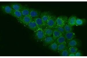 IF analysis of CCDC115 using anti-CCDC115 antibody (ABIN7599042). (CCDC115 Antikörper  (AA 1-180))