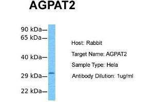 Host:  Rabbit  Target Name:  AGPAT2  Sample Tissue:  Human Hela  Antibody Dilution:  1. (AGPAT2 Antikörper  (C-Term))