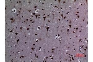 Immunohistochemical analysis of paraffin-embedded human-brain, antibody was diluted at 1:100. (HSP90 Antikörper  (acLys284, acLys292))