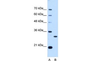 Western Blotting (WB) image for anti-PSME3 (PSME3) antibody (ABIN2462948) (PSME3 Antikörper)